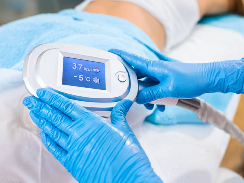 Fat Freezing in Singapore: Popular Treatment Areas